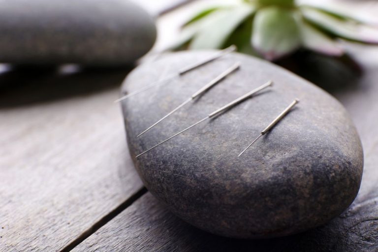 Pijnstillers: waarom medicijnen als acupunctuur gewoon werkt?
