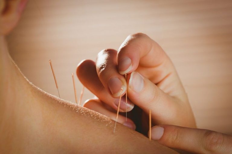 Is acupunctuur een alternatief voor opioïden?