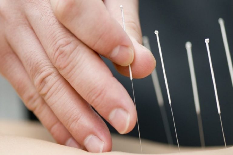 Acupunctuur: nu ook bekend waarom het werkt