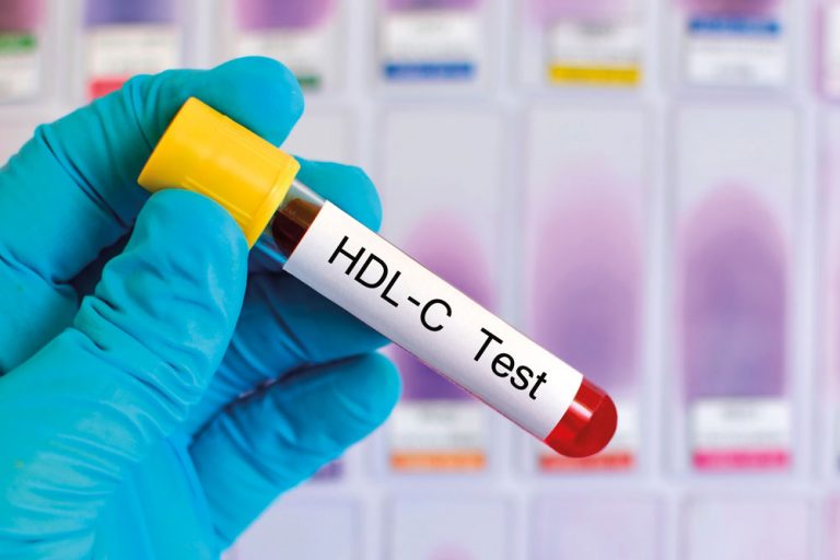 ‘Goed’ HDL-cholesterol kan een fatale hartaanval veroorzaken