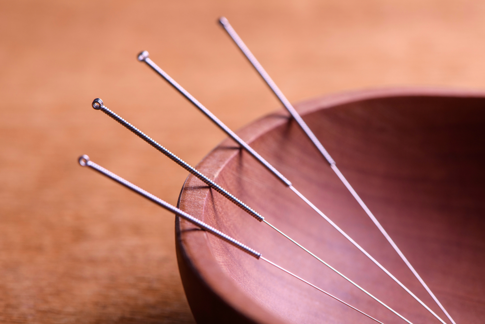 Acupunctuur vs. dry needling